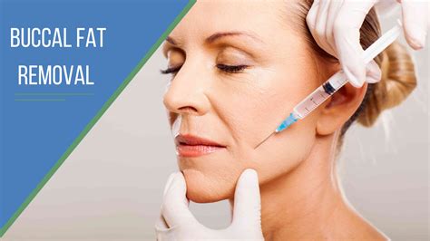 buccal fat removal phoenix|44 Buccal Fat Removal doctors in Phoenix, AZ .